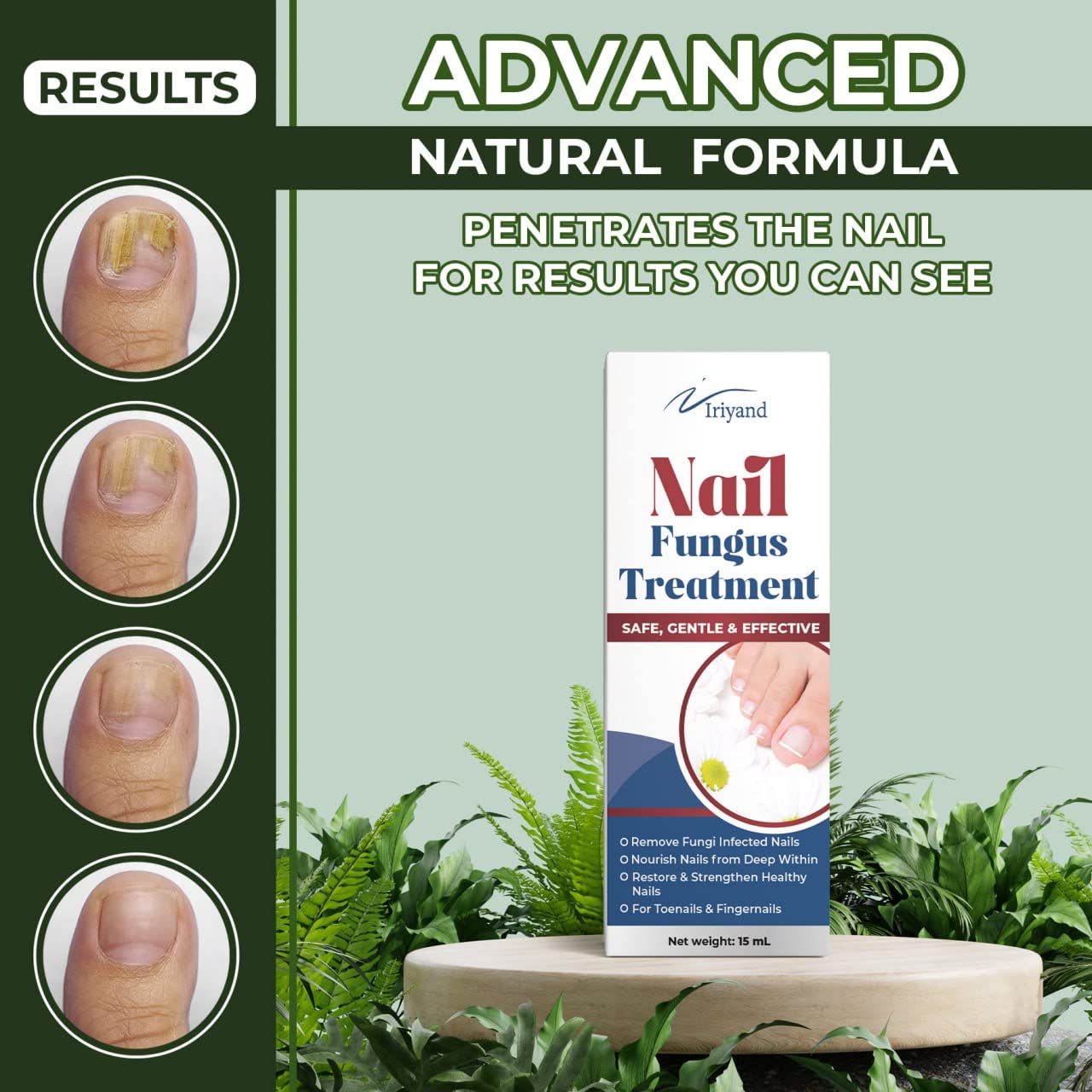 Extra Strength Toenail Fungus Treatment For Toenail Or Fingernail, Nail  Repair Solution, Nail Renewal Liquid For Damaged & Discoloration Nail(1oz)  : Amazon.ca: Beauty & Personal Care